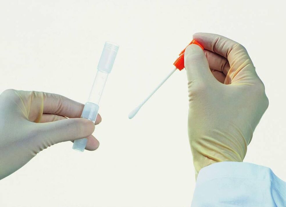 Collection of tests to detect chronic prostatitis