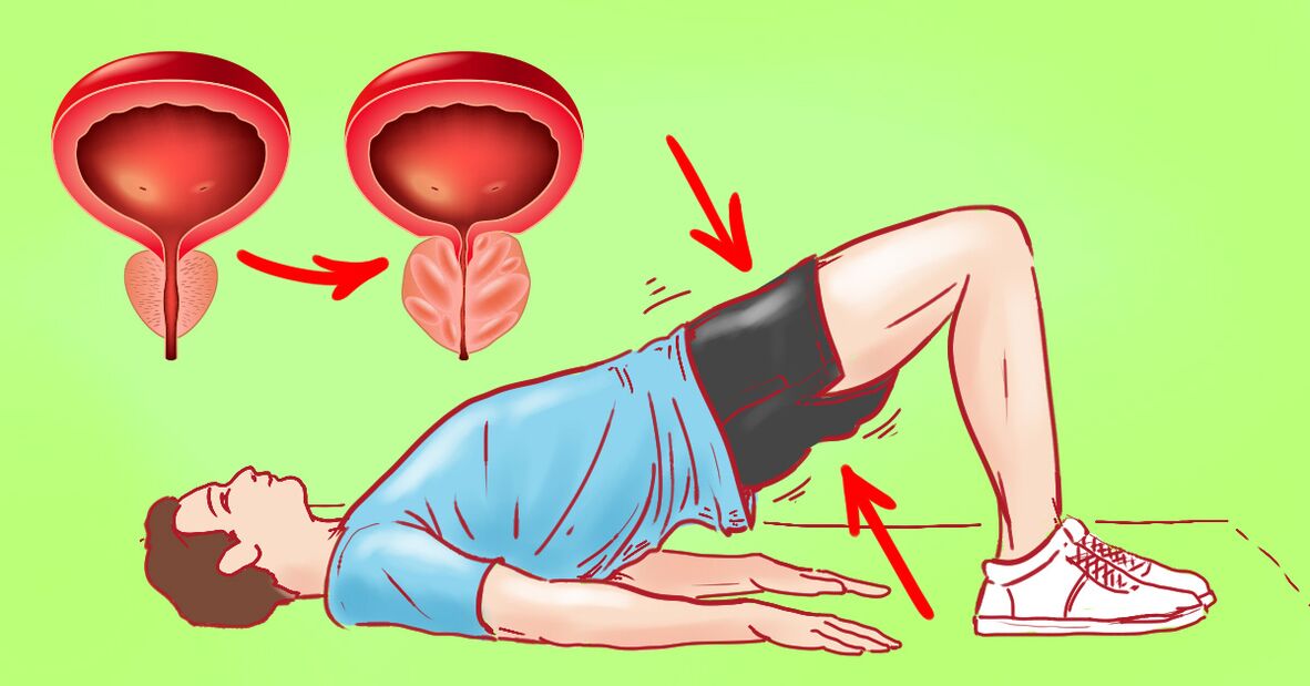 Therapeutic exercises for chronic prostatitis